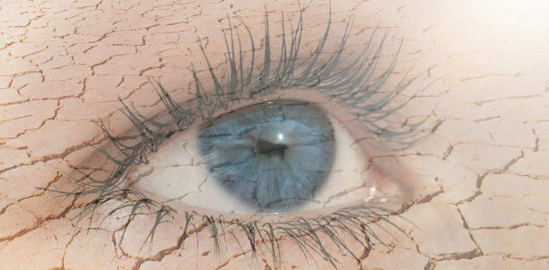 Close-up of a dry eye with a cracked texture illustrating dry eye symptoms